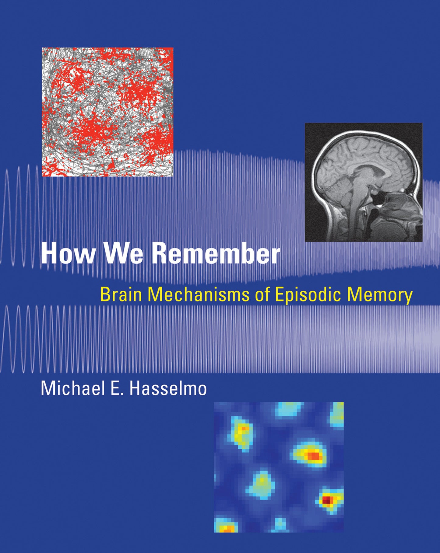 How We Remember - Brain Mechanisms of Episodic Memory