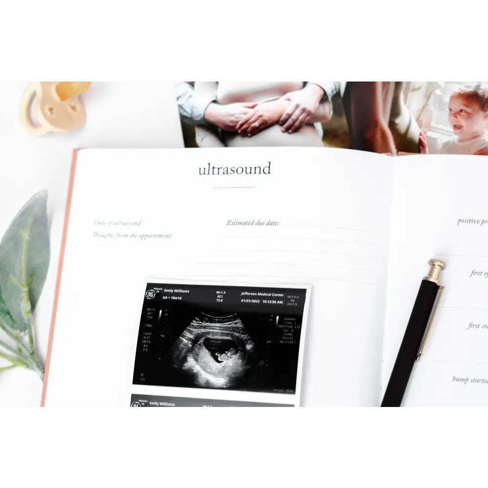 Pregnancy Journal Journal