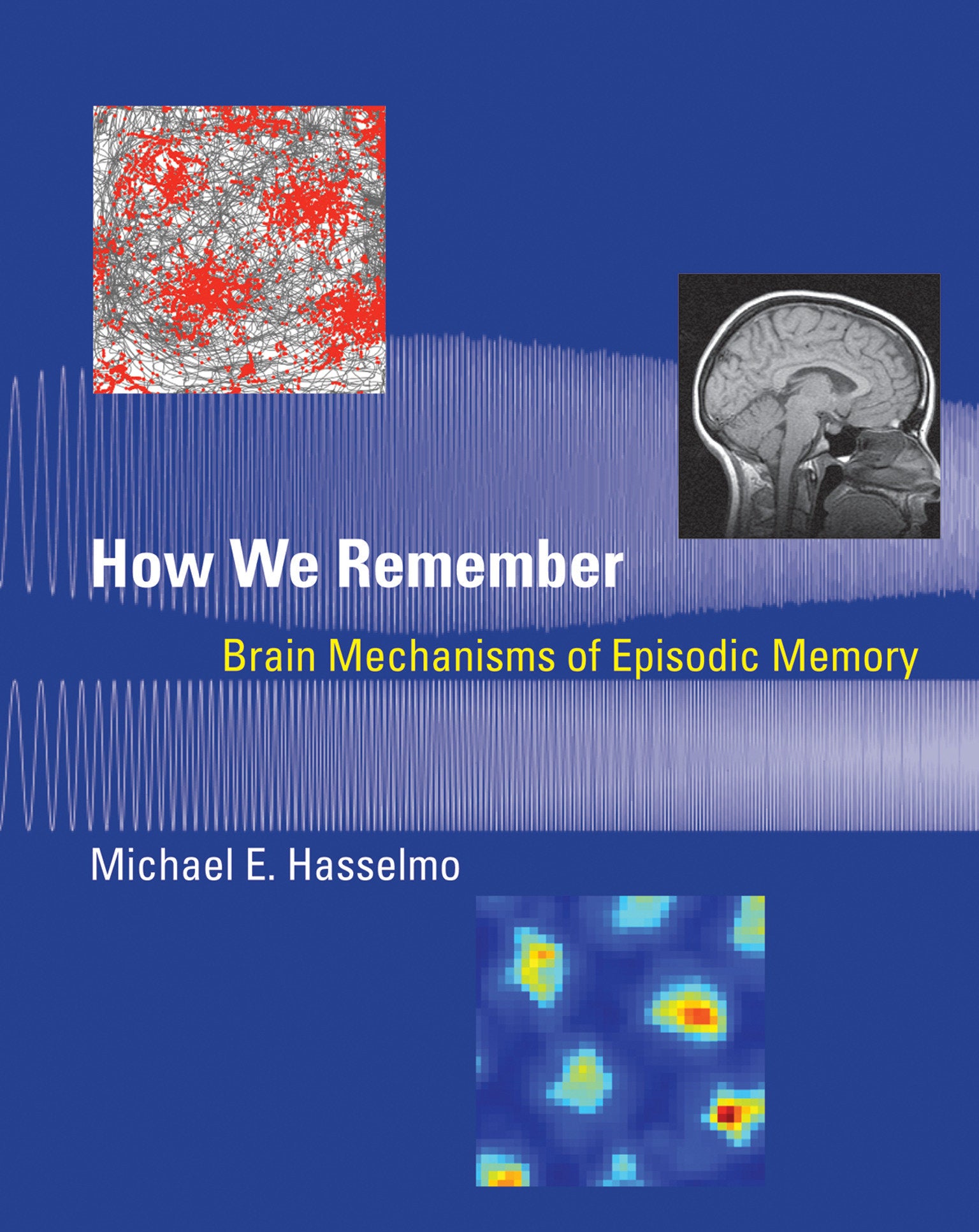 How We Remember - Brain Mechanisms of Episodic Memory