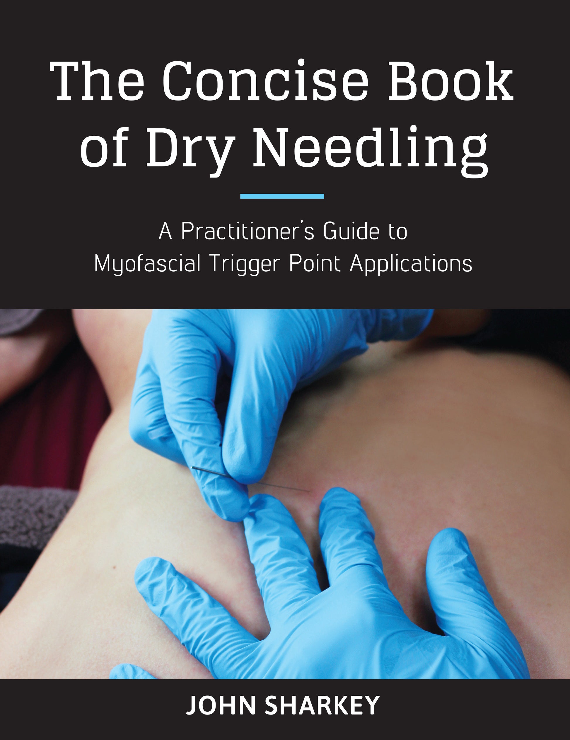 The Concise Book of Dry Needling - A Practitioner's Guide to Myofascial Trigger Point Applications