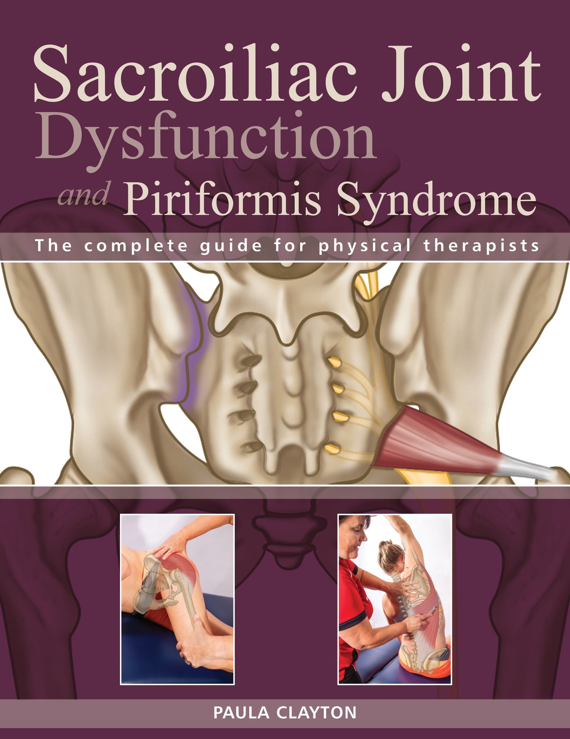 Sacroiliac Joint Dysfunction and Piriformis Syndrome - The Complete Guide for Physical Therapists